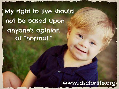 Downs syndrome baby-beautiful